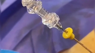 لیزر دیسک کمر . دکتر علی اثنی عشری . متخصص مغز و اعصاب کلینیک درد مهرگان