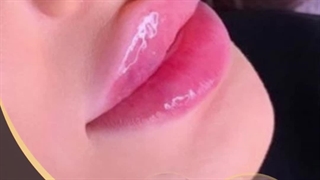 کلینیک تزریق ژل در کرج