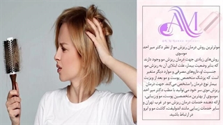 پرسش و پاسخ هایی از کاشت موی طبیعی