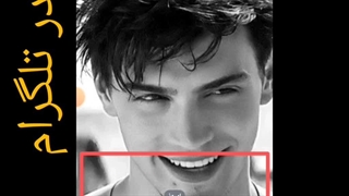 رفع فیلتری روبیکا تضمینی