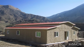 عوامل تاثیر گزار بر قیمت کانکس دندان پیش