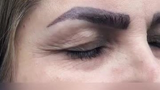 دکتر مجتبی سهراب پور پروتز سینه