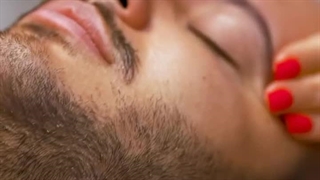 مطب دکتر آکو حمزه ای کاشت مو