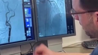 تنگی_کاروتید