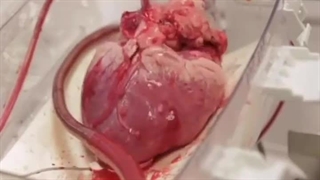 دکتر نادر انوشه بلیچینگ