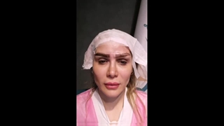 کاشت ابرو بدون جراحی؛ بهترین روش (۱۰۰% طبیعی و تضمینی)