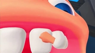 واقعیت مجاری با پیکامی _ شبیه ساز دندان پزشکی _ته خنده ست