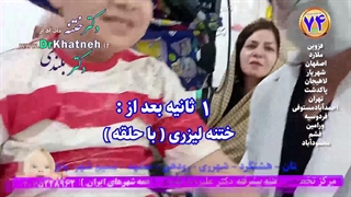 بهترین دکتر ختنه پیشرفته بدون درد نوزادان